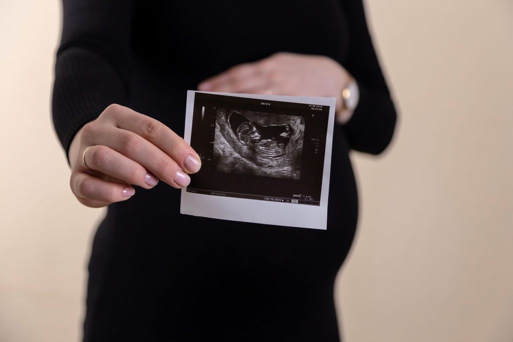 Une femme enceinte montrant une photo de son echographie